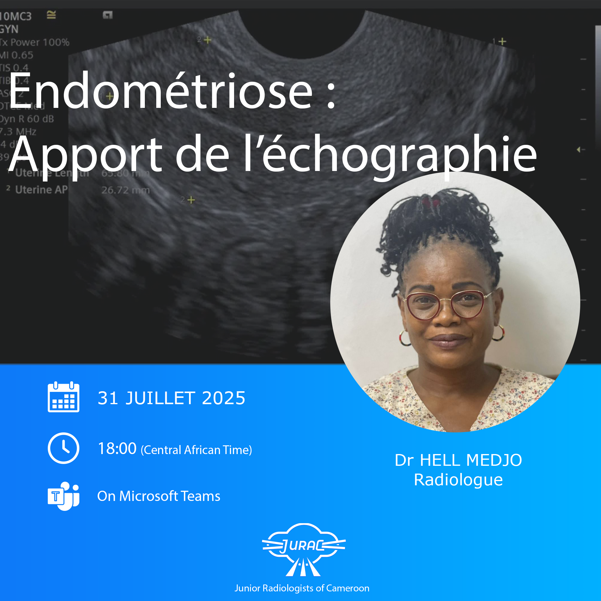 Endométriose: apport de l’échographie — Dr Hell Medjoo