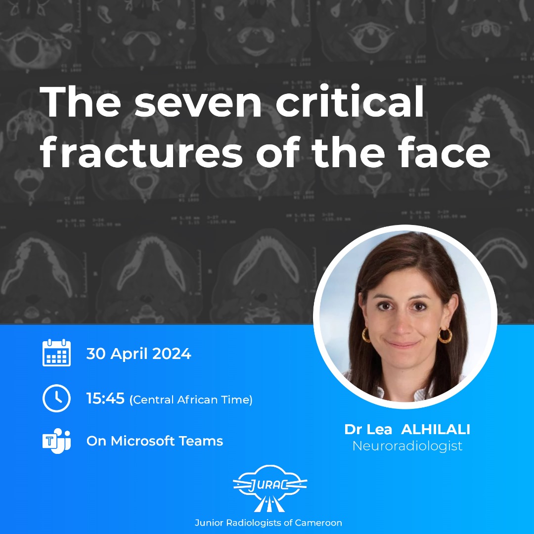The seven critical fractures of the face — Dr Lea Alhilali